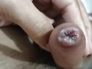 Syphilis (sexual transmitted disease) made my dick looking swallen. look at it